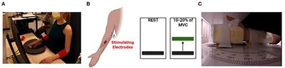 Reduced wrist flexor H-reflex excitability is linked with increased wrist proprioceptive error in adults with cerebral palsy